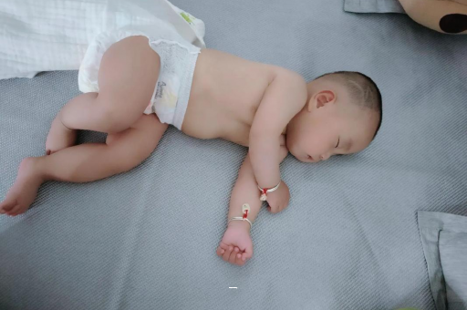 栖霞宝宝脸上有白色斑块